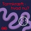 undefined Tarmkræft – hvad nu?
