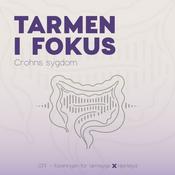 Podcast Tarmen i Fokus - Crohns sygdom