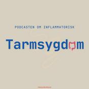 Podcast Podcasten om Inflammatoriske Tarmsygdom
